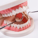 השתלות שיניים בטורקיה ברמה גבוהה לחיוך מלא ובריא